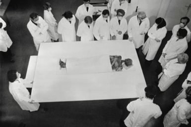 La mummia di Ramses II al Musee de l&#39;Homme di Parigi nel 1976, dove i resti del faraone trascorsero otto mesi in terapia intensiva mentre gli esperti si occupavano di problemi di parassiti e funghi