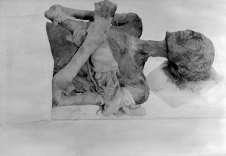 I resti di Ramses II, una mummia straordinariamente conservata che ha ricevuto cure mediche urgenti in Francia nel 1976 al Musee de l&#39;Homme